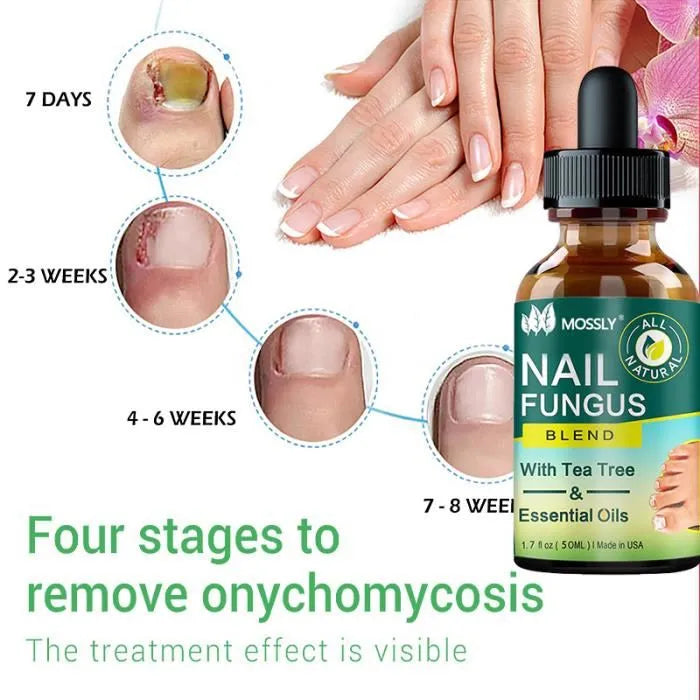 NAIL GROWTH & REPAIR SERUM (BUY 1 GET 1 FREE) (PACK OF 2)