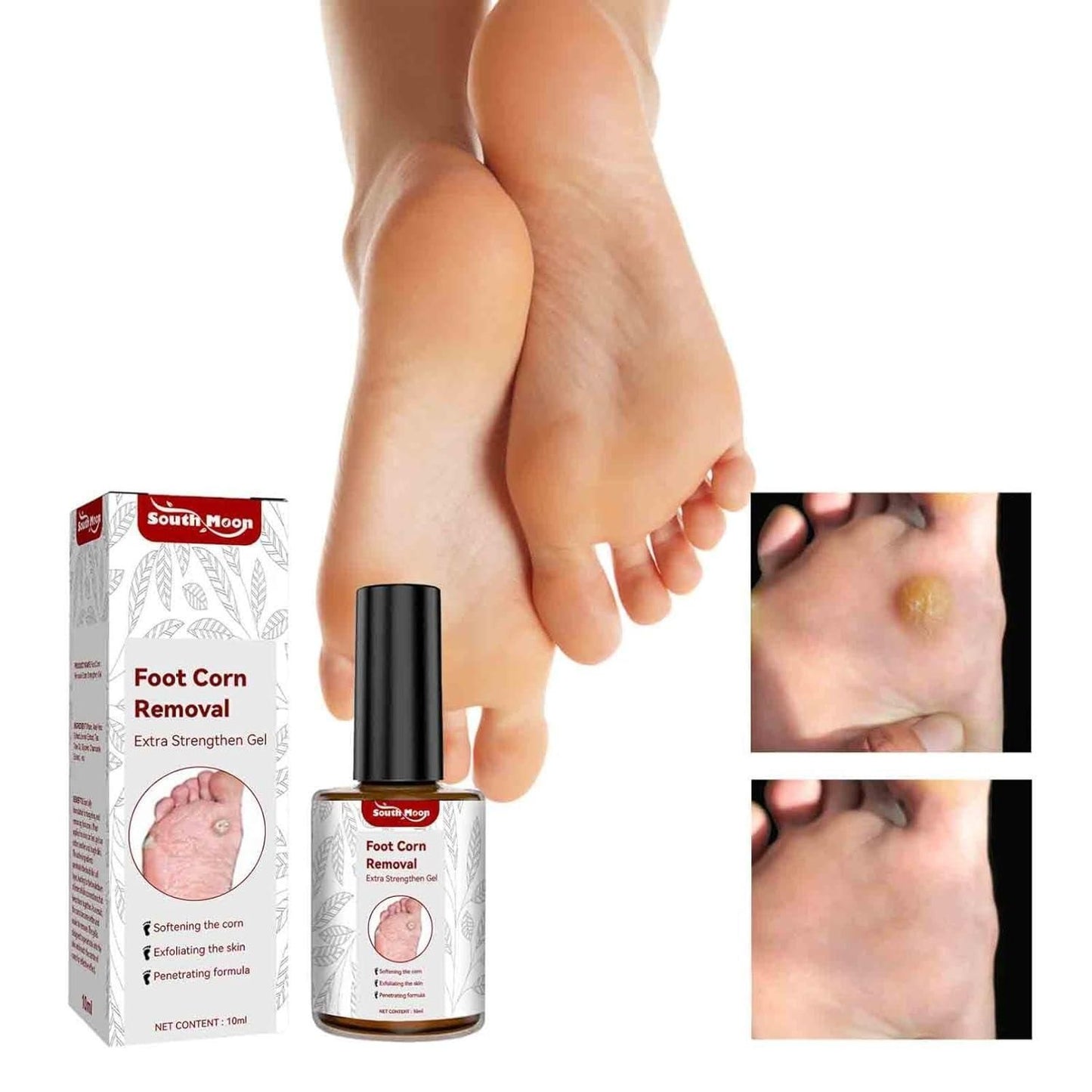 FEET CORN REMOVAL SERUM